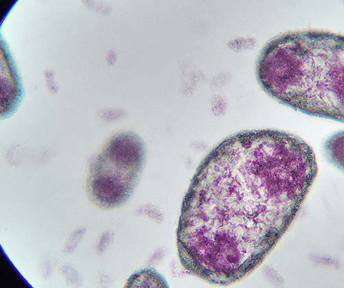 toxoplasma gondii